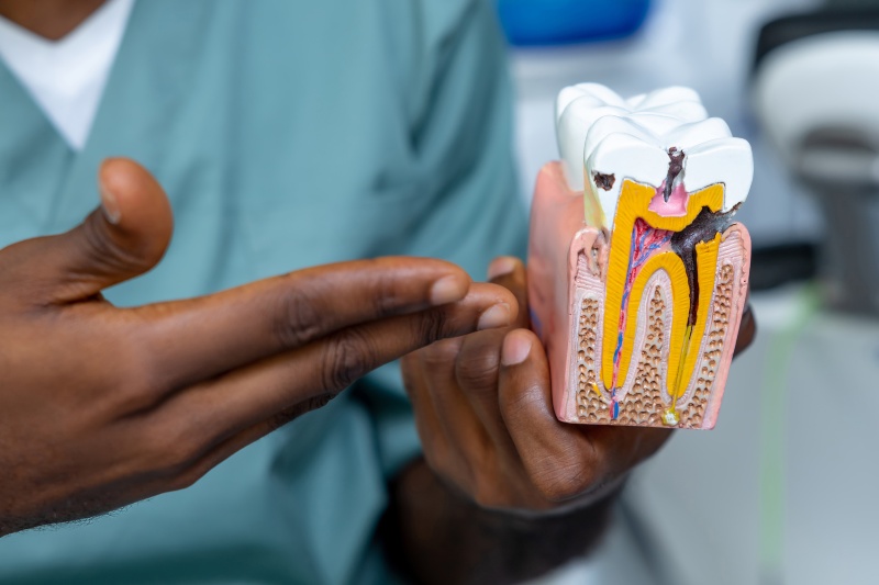 Featured image for “Debunking Myths About Root Canal Treatment”